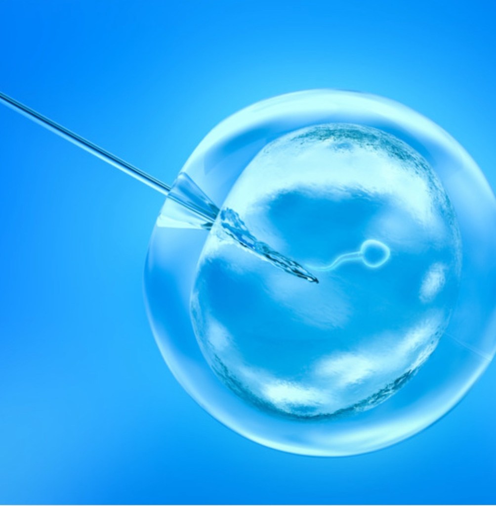 Human sperm being injected into an egg via ICSI.